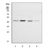 Western blot testing of human 1) HeLa, 2) 293T, 3) HepG2 and 4) K562 cell lysate with ILKAP antibody. Predicted molecular weight ~43 kDa.