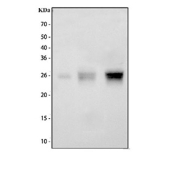 Western blot testing of 1) human Caco-2, 2) mouse brain and 3) rat brain tissue lysate with DNAJC5 antibody. Predicted molecular weight: ~19 kDa, ~22 kDa (two isoforms).