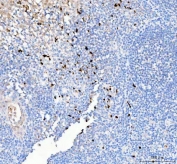 IHC staining of FFPE human tonsil tissue with Pellino 2 antibody. HIER: boil tissue sections in pH8 EDTA for 20 min and allow to cool before testing.