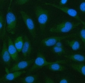 Immunofluorescent staining of FFPE human HeLa cells with Pellino 2 antibody (green) and DAPI nuclear stain (blue). HIER: steam section in pH6 citrate buffer for 20 min.