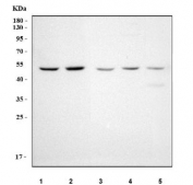 Western blot testing of 1) human Raji, 2) human Ramos, 3) rat spleen, 4) rat testis and 5) mouse testis tissue lysate with Pellino 2 antibody. Predicted molecular weight ~46 kDa.