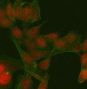 Immunofluorescent staining of FFPE human HeLa cells with PATZ1 antibody (red) and Beta Tubulin mAb (green). HIER: steam section in pH6 citrate buffer for 20 min.