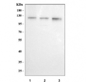 Western blot testing of human 1) A431, 2) A549 and 3) SiHa cell lysate with JADE2 antibody. Predicted molecular weight ~87 kDa.