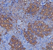 IHC staining of FFPE rat kidney tissue with LIN7C antibody. HIER: boil tissue sections in pH8 EDTA for 20 min and allow to cool before testing.