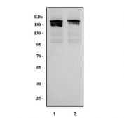 Western blot testing of human 1) HepG2 and 2) Caco-2 cell lysate with Ribosome binding protein 1 antibody. Expected molecular weight ~180 kDa.