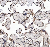 IHC staining of FFPE human placental tissue with MAGEL2 antibody. HIER: boil tissue sections in pH8 EDTA for 20 min and allow to cool before testing.