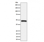 Western blot testing of human HeLa, cell lysate with ING1 antibody. Expected molecular weight ~47 kDa.