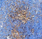 IHC staining of FFPE rat thymus tissue with Aiolos antibody. HIER: boil tissue sections in pH8 EDTA for 20 min and allow to cool before testing.