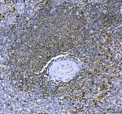 IHC staining of FFPE mouse spleen tissue with Aiolos antibody. HIER: boil tissue sections in pH8 EDTA for 20 min and allow to cool before testing.