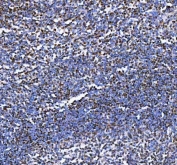 IHC staining of FFPE human tonsil tissue with Aiolos antibody. HIER: boil tissue sections in pH8 EDTA for 20 min and allow to cool before testing.