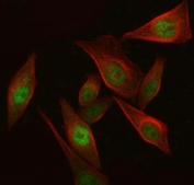 Immunofluorescent staining of FFPE human SiHa cells with Aiolos antibody (green) and Beta Tubulin mAb (red). HIER: steam section in pH6 citrate buffer for 20 min.