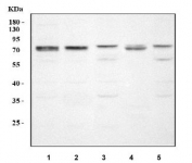 Western blot testing of 1) human RT4, 2) human A549, 3) rat C6, 4) mouse kidney and 5) mouse NIH 3T3 cell lysate with PADI3 antibody. Predicted molecular weight ~75 kDa.