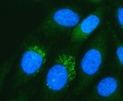 Immunofluorescent staining of FFPE human HeLa cells with PADI3 antibody (green) and DAPI nuclear stain (blue). HIER: steam section in pH6 citrate buffer for 20 min.