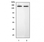 Western blot testing of 1) rat brain and 2) mouse brain tissue lysate with ICAM5 antibody. Predicted molecular weight ~97 kDa but may be observed at higher molecular weights due to glycosylation.