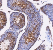 IHC staining of FFPE mouse testis tissue with IFT52 antibody. HIER: boil tissue sections in pH8 EDTA for 20 min and allow to cool before testing.