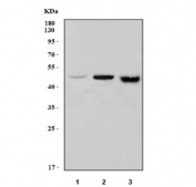 Western blot testing of 1) human SH-SY5Y, 2) rat testis and 3) mouse testis tissue with IFT52 antibody. Predicted molecular weight ~50 kDa.