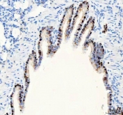 IHC staining of FFPE rat lung tissue with PARP3 antibody. HIER: boil tissue sections in pH8 EDTA for 20 min and allow to cool before testing.