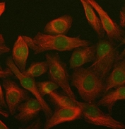 Immunofluorescent staining of FFPE human HeLa cells with PARP3 antibody (green) and Beta Tubulin mAb (red). HIER: steam section in pH6 citrate buffer for 20 min.