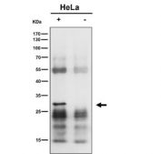 Immunoprecipitation of MTAP protein from human HeLa whole cell lysate using MTAP antibody at 1:50.