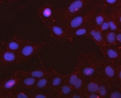 Immunofluorescent staining of FFPE human U-2 OS cells with PCDHGC4 antibody (red) and DAPI nuclear stain (blue). HIER: steam section in pH6 citrate buffer for 20 min.