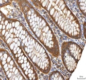 IHC staining of FFPE human colon tissue with EIF3B antibody. HIER: boil tissue sections in pH8 EDTA for 20 min and allow to cool before testing.