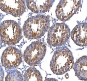 IHC staining of FFPE rat testis tissue with EIF3B antibody. HIER: boil tissue sections in pH8 EDTA for 20 min and allow to cool before testing.