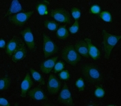 Immunofluorescent staining of FFPE human SiHa cells with EIF3B antibody (green) and DAPI nuclear stain (blue). HIER: steam section in pH6 citrate buffer for 20 min.