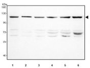 Western blot testing of human 1) 293T, 2) Jurkat, 3) HeLa, 4) Caco-2, 5) MCF7 and 6) K562 cell lysate with EIF3B antibody. Expected molecular weight ~116 kDa.