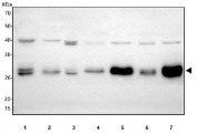 Western blot testing of 1) human HepG2, 2) human Jurkat, 3) human MCF7, 4) rat brain, 5) rat liver, 6) mouse brain and 7) mouse liver tissue lysate with HAGH antibody. Predicted molecular weight: 25-34 kDa (multiple isoforms).