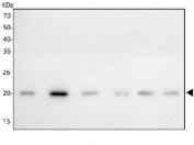 Western blot testing of 1) human K562, 2) human HepG2, 3) human HeLa, 4) human A549, 5) rat liver and 6) mouse liver tissue lysate with ITPA antibody. Predicted molecular weight ~21 kDa.