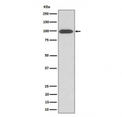 Western blot testing of human U-87 MG cell lysate with Integrin beta 3 antibody. Predicted molecular weight ~88 kDa but may be observed at higher molecular weights due to glycosylation.