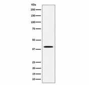 Western blot testing of human JAR cell lysate with DLX3 antibody. Predicted molecular weight ~32 kDa, commonly observed at 32-38 kDa.