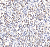 IHC staining of FFPE human testicular seminoma tissue with HEPACAM2 antibody. HIER: boil tissue sections in pH8 EDTA for 20 min and allow to cool before testing.