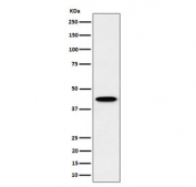 Western blot testing of human HepG2 cell lysate with Inositol-tetrakisphosphate 1-kinase antibody. Predicted molecular weight ~46 kDa.