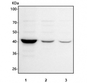 Western blot testing of human 1) MCF7, 2) 293T and 3) U-251 cell lysate with ITPK1 antibody. Predicted molecular weight ~46 kDa.