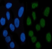 Immunofluorescent staining of FFPE human HeLa cells with Phospho-STAT3 antibody (green) and DAPI nuclear stain (blue). HIER: steam section in pH6 citrate buffer for 20 min.