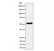 Western blot testing of human Jurkat cell lysate with GPRC5B antibody. Predicted molecular weight ~45 kDa but may be observed at higher molecular weights due to glycosylation.