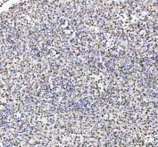 IHC staining of FFPE human spleen tissue with ARID domain-containing protein 1A antibody. HIER: boil tissue sections in pH8 EDTA for 20 min and allow to cool before testing.