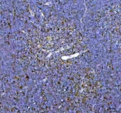IHC staining of FFPE rat thymus tissue with ARID domain-containing protein 1A antibody. HIER: boil tissue sections in pH8 EDTA for 20 min and allow to cool before testing.