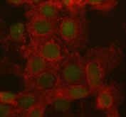 Immunofluorescent staining of FFPE human A431 cells with ARID domain-containing protein 1A antibody (green) and Beta Tubulin mAb (red). HIER: steam section in pH6 citrate buffer for 20 min.