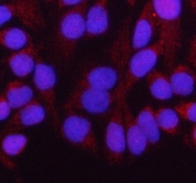 Immunofluorescent staining of FFPE human HeLa cells with HADH antibody (red) and DAPI nuclear stain (blue). HIER: steam section in pH6 citrate buffer for 20 min.