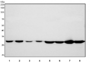 Western blot testing of 1) human HepG2, 2) human Jurkat, 3) human 293T, 4) human A431, 5) rat liver, 6) rat kidney, 7) mouse liver and 8) mouse kidney tissue lysate with HADH antibody. Predicted molecular weight: ~34 kDa.