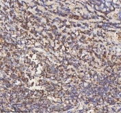 IHC staining of FFPE human tonsil tissue with HADH antibody. HIER: boil tissue sections in pH8 EDTA for 20 min and allow to cool before testing.