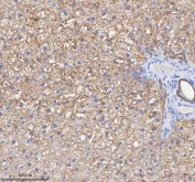 IHC staining of FFPE rat alcohol liver tissue with HADH antibody. HIER: boil tissue sections in pH8 EDTA for 20 min and allow to cool before testing.
