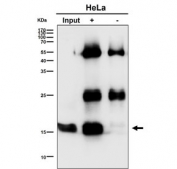 Immunoprecipitation of UBE2D1 protein from 500ug of human HeLa whole cell lysate using UBE2D1 antibody at 1:50.