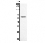 Western blot testing of human Hut-78 cell lysate with Interferon regulatory factor 4 antibody. Predicted molecular weight ~51 kDa.