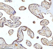 IHC staining of FFPE human placental tissue with METTL18 antibody. HIER: boil tissue sections in pH8 EDTA for 20 min and allow to cool before testing.