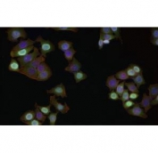 Immunofluorescent staining of FFPE human HeLa cells with Phospho-MDM2 antibody (green), phalloidin (red) and DAPI nuclear stain (blue). HIER: steam section in pH6 citrate buffer for 20 min.