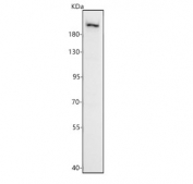 Western blot testing of human HepG2 cell lysate with PEG3 antibody. Predicted molecular weight ~180 kDa.