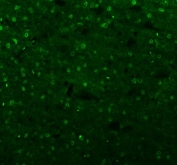 Immunofluorescent staining of FFPE mouse brain tissue with Islet 1 antibody (green). HIER: steam section in pH8 EDTA buffer for 20 min.